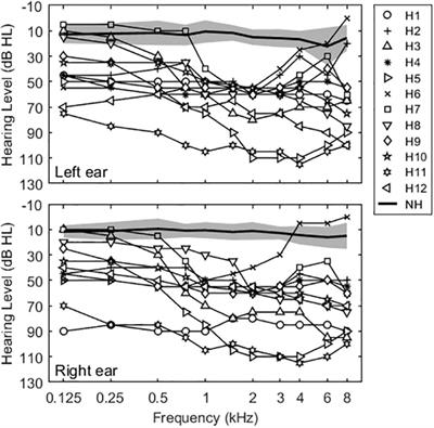 Factors underlying masking release by voice-gender differences and spatial separation cues in multi-talker listening environments in listeners with and without hearing loss